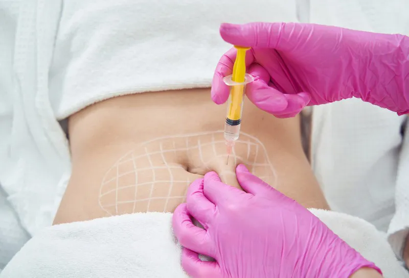 A New Era in Fat Loss and Metabolic Health: GLP-1 Agonists Meet Non-Thermal High-Energy Lasers