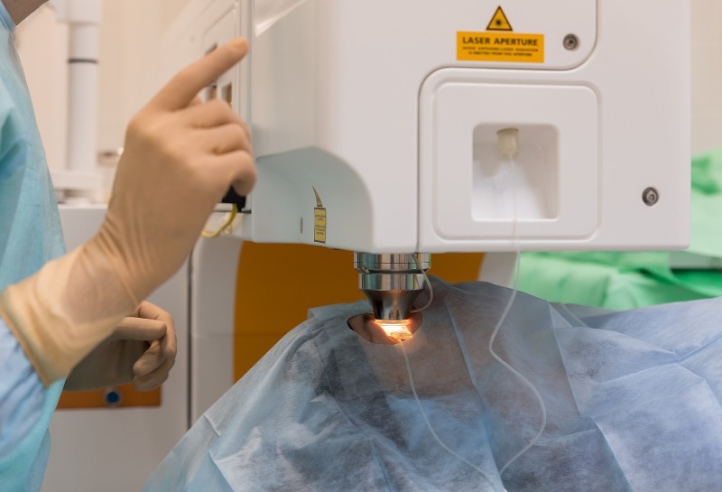 Deregulation of Lasers: A Suppliers View