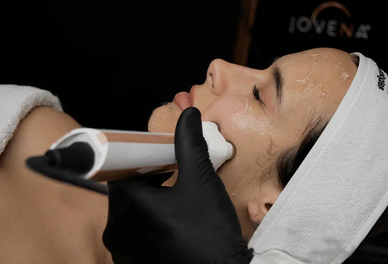 FaceSTIM by Jovena: Aesthetic Innovation with Immediate ROI