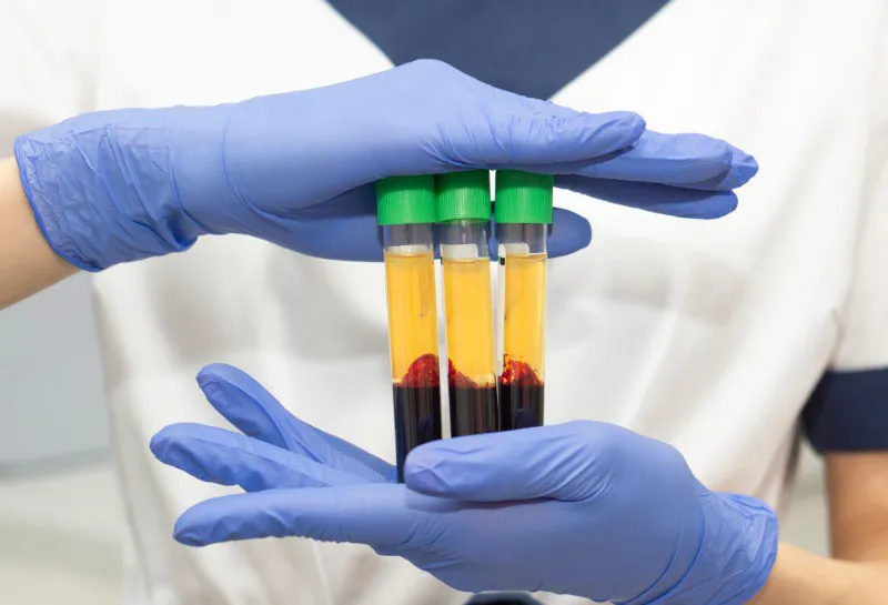 Is Your Clinic Really Ready for PRP?