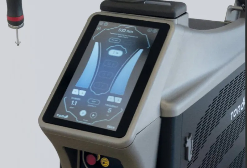 Lynton TORO Laser Launch – Multi-Wavelength Tattoo Removal for Clinics
