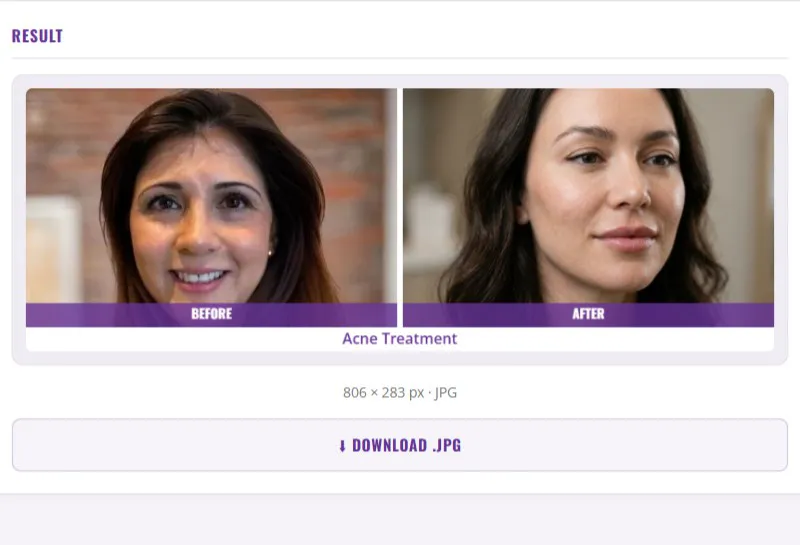 New Member Tool: Before and After Collage Builder, Create Professional Comparison Images in Minutes