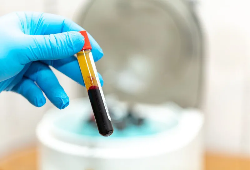 New PRP FAQ Now Live, and How Clinics Can Use It