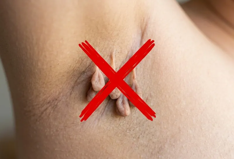 New Skin Tag Removal FAQ Now Live, and How Clinics Can Use It