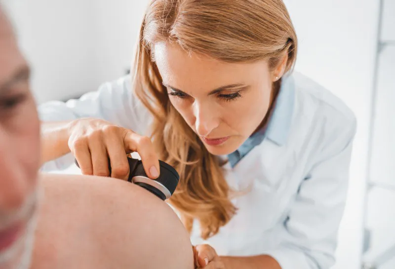 Non-melanoma Skin Cancer Deaths Will Overtake Melanoma Deaths