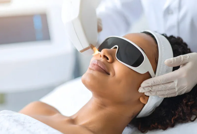 Precision, Comfort, and Confidence: Advancing Facial Hair Removal With the Alpha Pro 808 NM Diode Laser