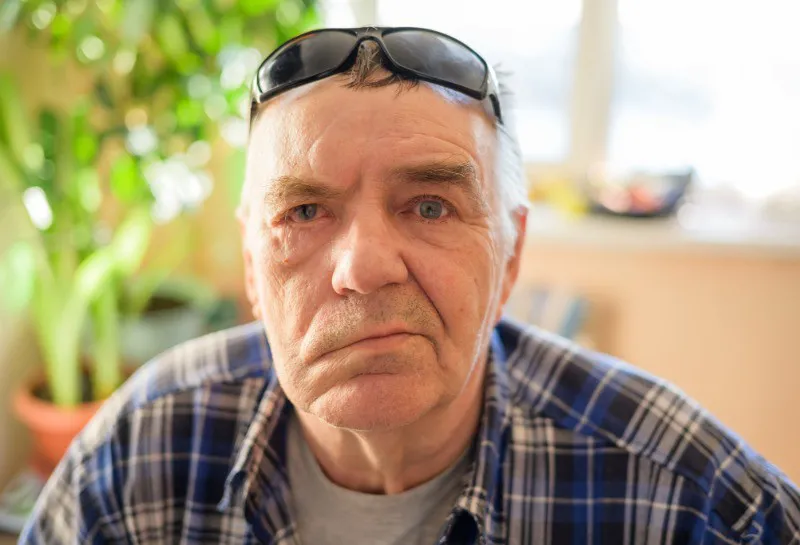 Treatment for Facial Palsy Is Deemed Cosmetic by the NHS