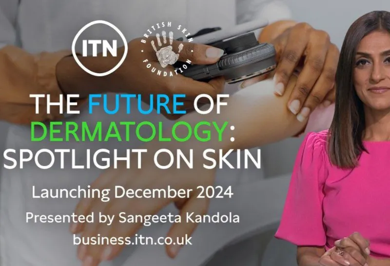 Want to Be Involved in a New ITN Business Programme?