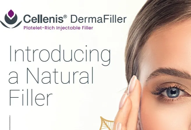 What You Need to Know About Cellenis PRP DermaFiller
