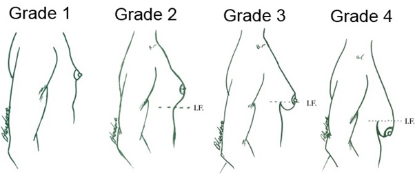 Thongs naked types of boobs pics learn fuck biggest
