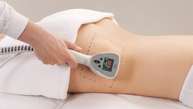 Exilis_Application_Hip