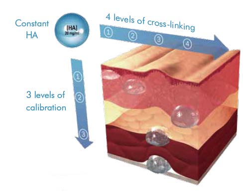 Illustration of the product Emervel depoistion levels