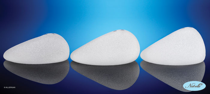 Everything You Need to Know About Natrelle Implants, BPS