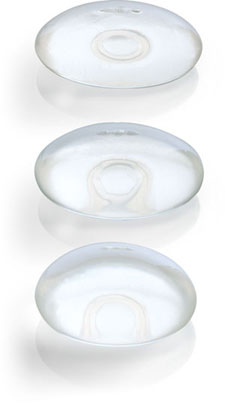 Mentor Smooth Round Saline Range of Breast Implants