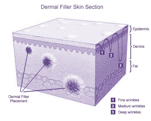 Dermal Fillers Skin Section