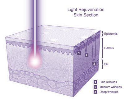 Light Rejuvenation Skin Section