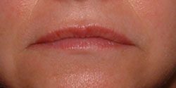 Lips Before