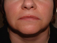 Female lips before micropigmentation