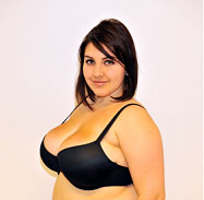 Female after liposuction breast reduction - Front View