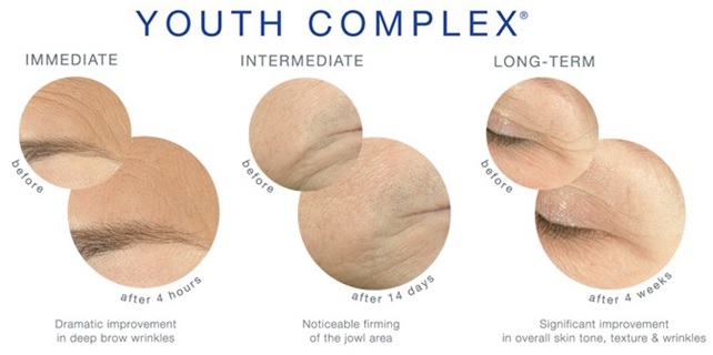 Youth Complex Before and After Data